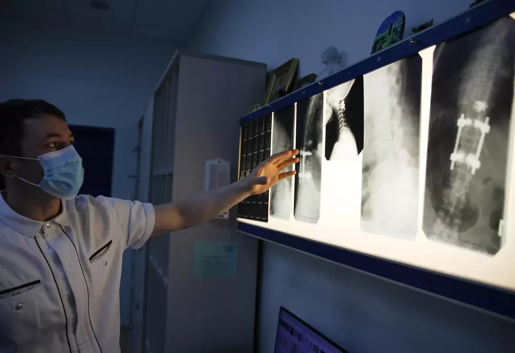 Medikuek zerbikal-osteokondrosia diagnostikatzen dute metodo instrumentalak erabiliz, erradiografia adibidez